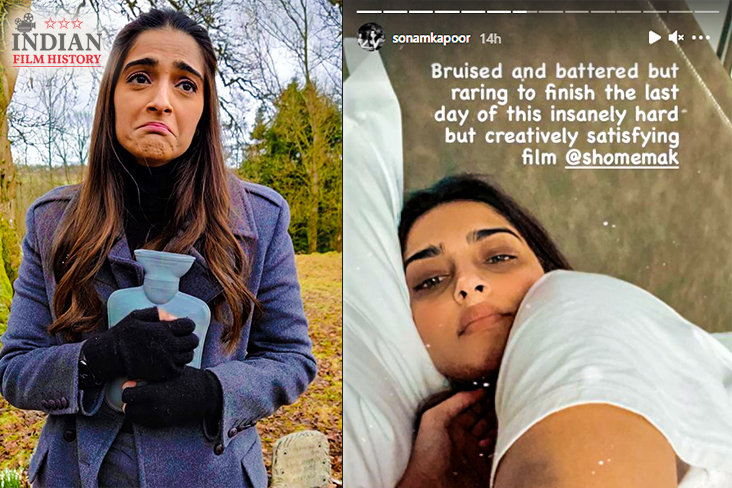 Sonam Kapoor Ahuja Gets Bruised While Filming ‘Blind’